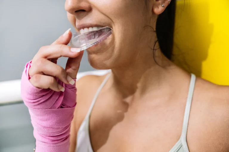 Mouth Guards